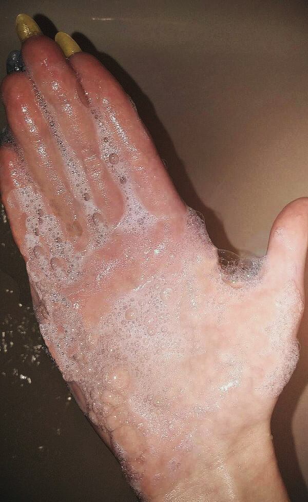 -2