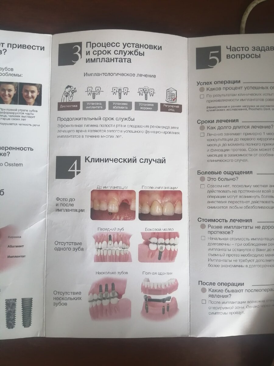 Как происходит имплантация