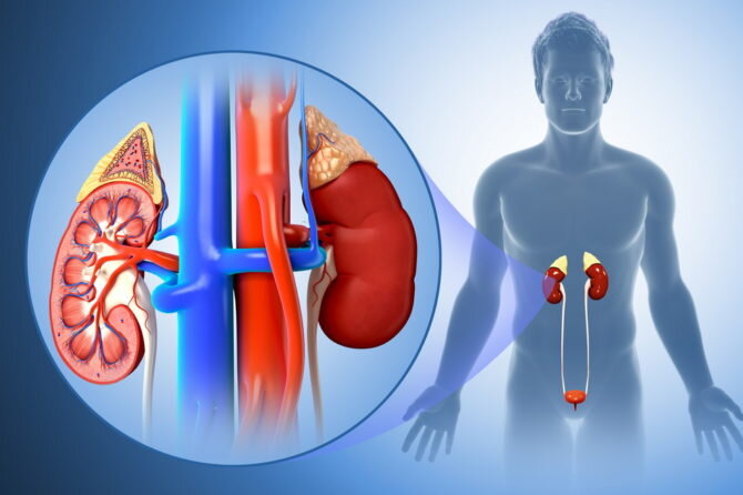 Пиелонефрит – заболевание, проявляющееся воспалительным процессом в почках. Чаще встречается у молодых женщин, в большинстве случаев затрагивает одну почку. Причиной острого пиелонефрита является бактериальная атака. Развитию болезни у женщин чаще всего предшествует цистит, у мужчин – мочекаменная болезнь, аденома и простатит. Помимо острого пиелонефрита болезнь бывает и хронической.