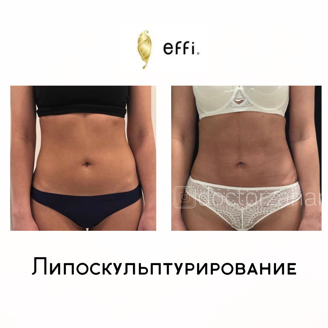 Клиника косметологии и пластической хирургии effi. Красноярск