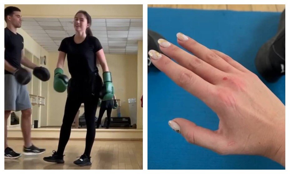    Загитова получила небольшую травму из-за занятий боксом. Фото: Личная страница Алины Загитовой в соцсетях