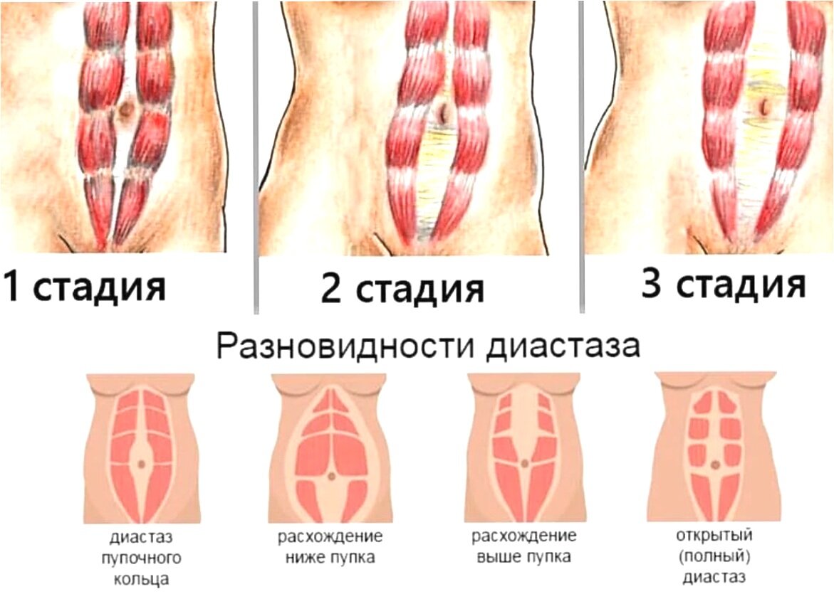 грудь перестает болеть в начале беременности фото 117