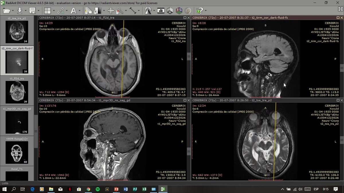 Интерфейс Radiant DICOM Viewer/ Источник фото: youtube.com