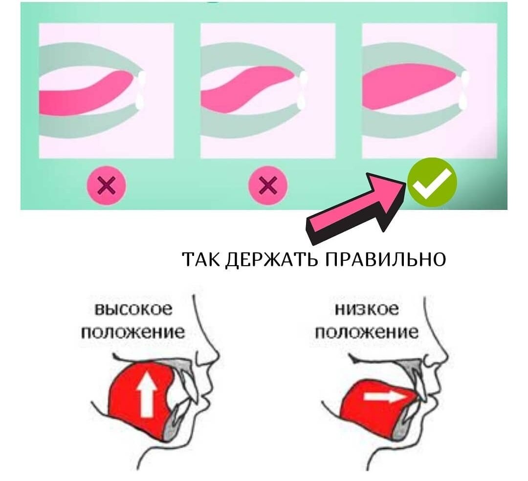 Упражнения для правильного положения языка во рту