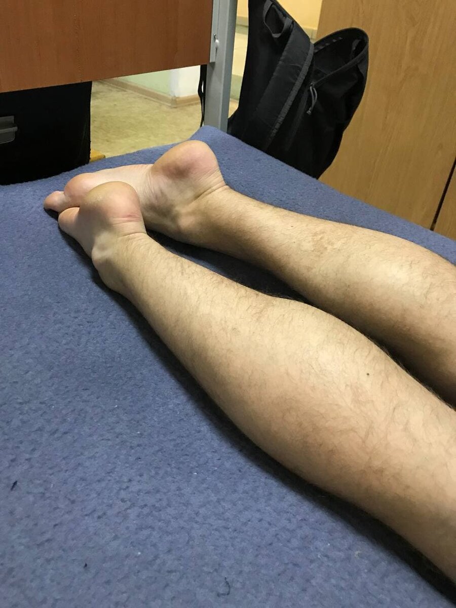 Легендарные ноги 43 размера