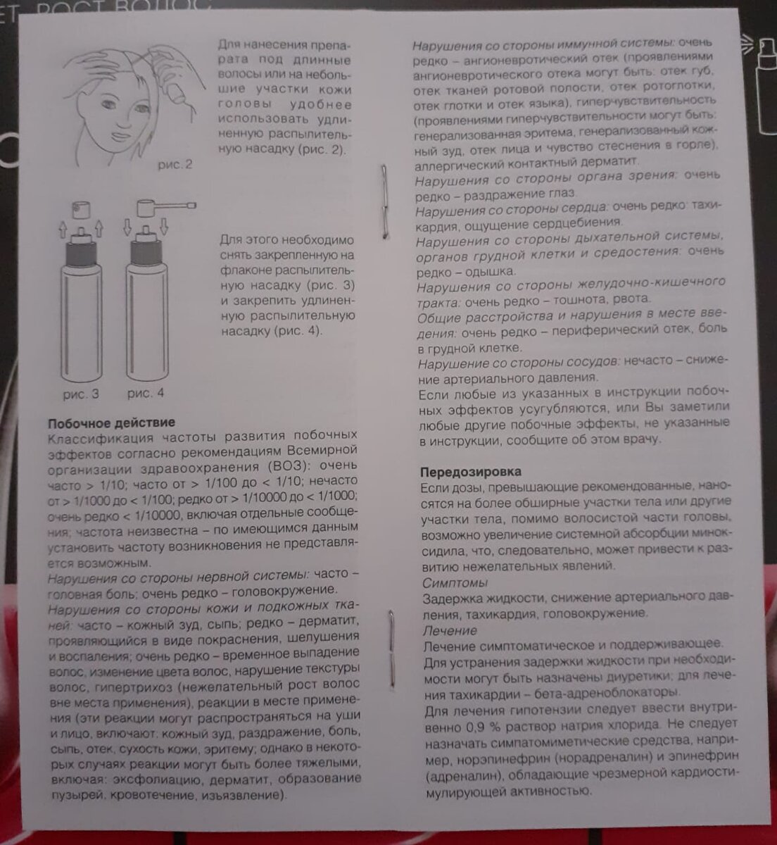 Средство от выпадения волос ALERANA (спрей 5%, 60 мл.). Миф или  реальность.... Честный обзор. | Информационный канал с различной тематикой  (красота, здоровье и пр.). | Дзен