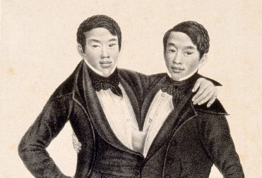 Чанг и Энг. Их тела были соединены в районе грудины.