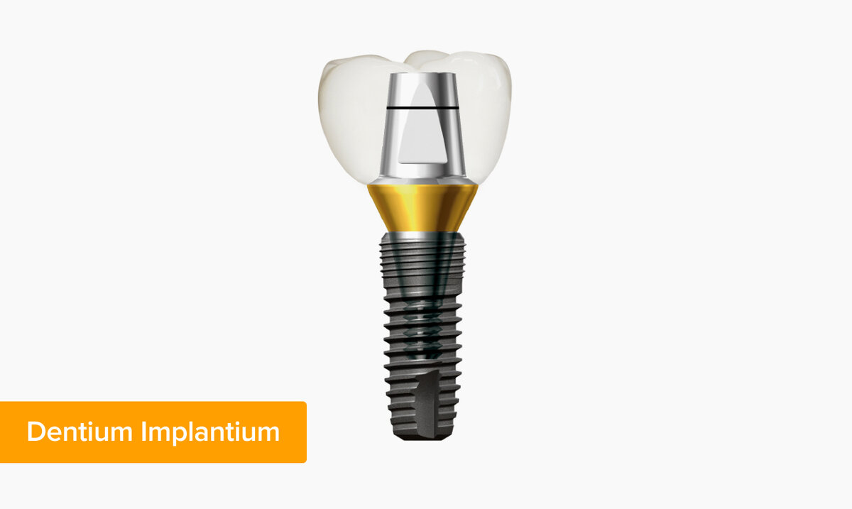 имплант системы dentium. имплант дентиум. система дентиум импланты. Dentium импланты логотип. имплант dentium корея.