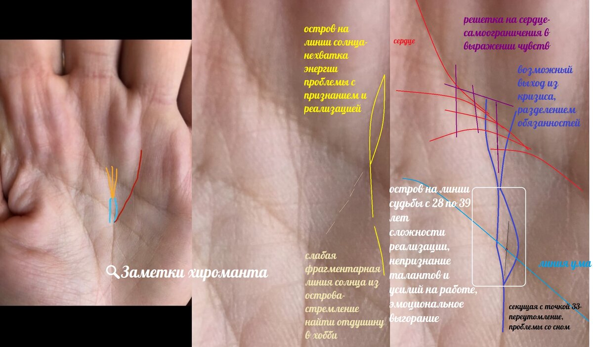 Хиромантия линия богатства. Немеют средний и безымянный пальцы рук. Линия судьбы на ладони. Датировка линии судьбы. Хиромантия линии сбоку ладони.