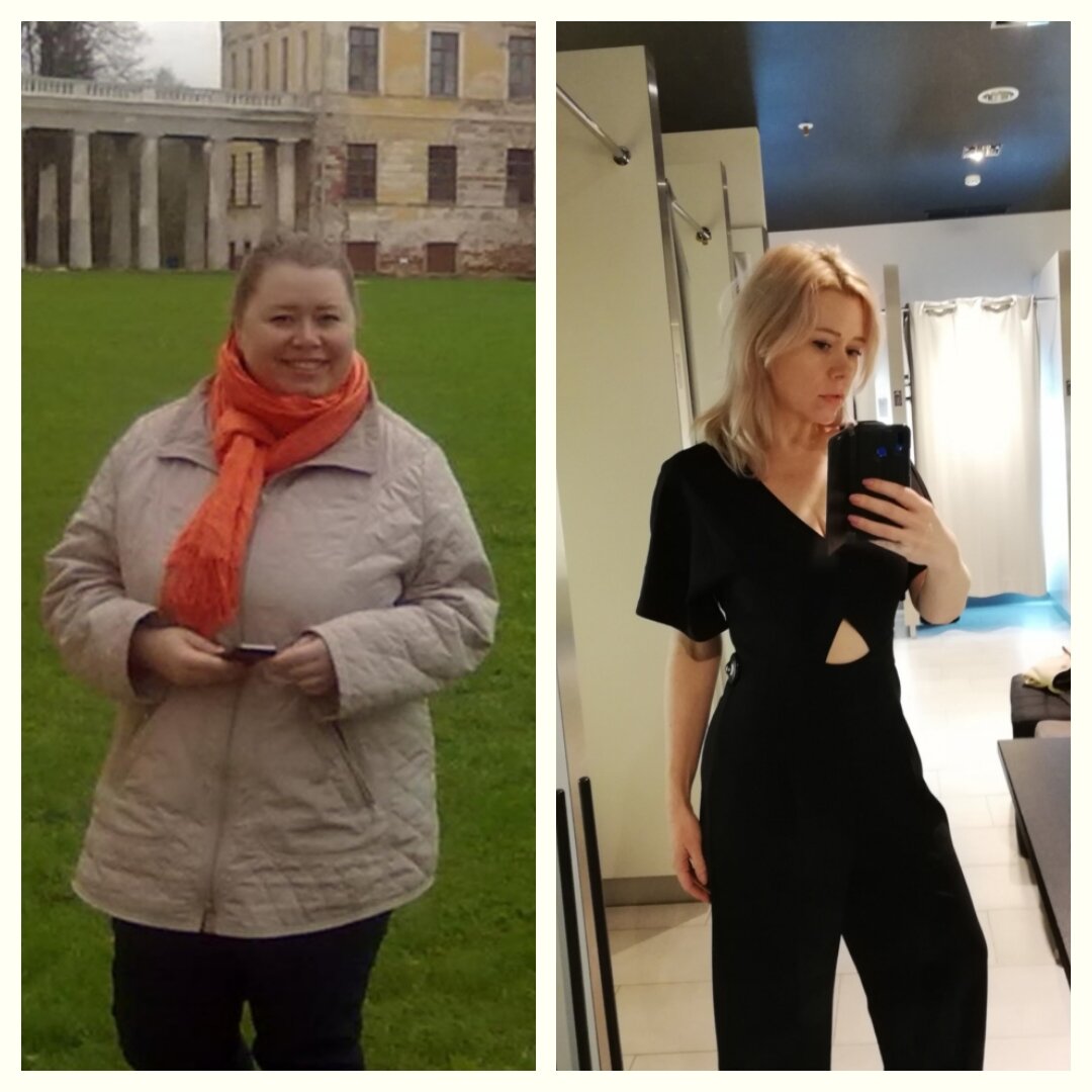 До и после похудения на 40 кг