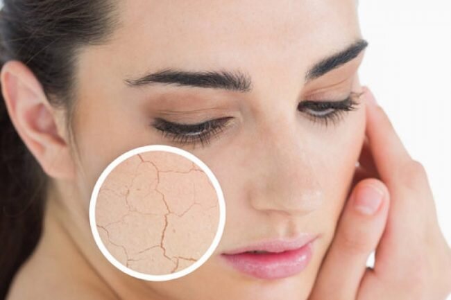 Как воздействует обветренность на состояние кожи?