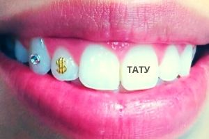 Татуировка на зубах