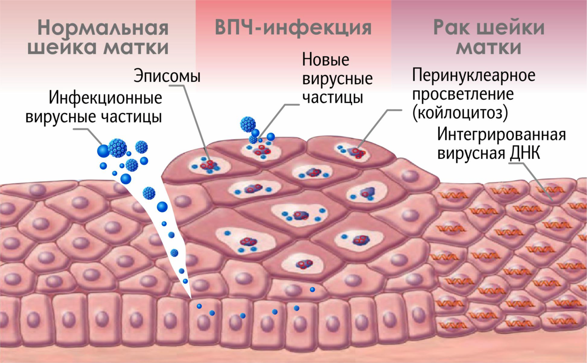 Hpv. ВИУС папиломы человека. Вирус папилломы человека (ВПЧ).