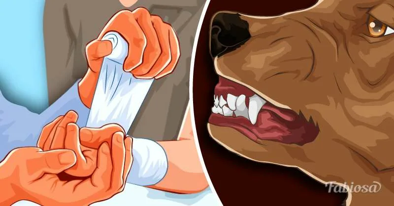 Что делать при укусе собаки: симптомы, последствия, первая помощь, профилактика