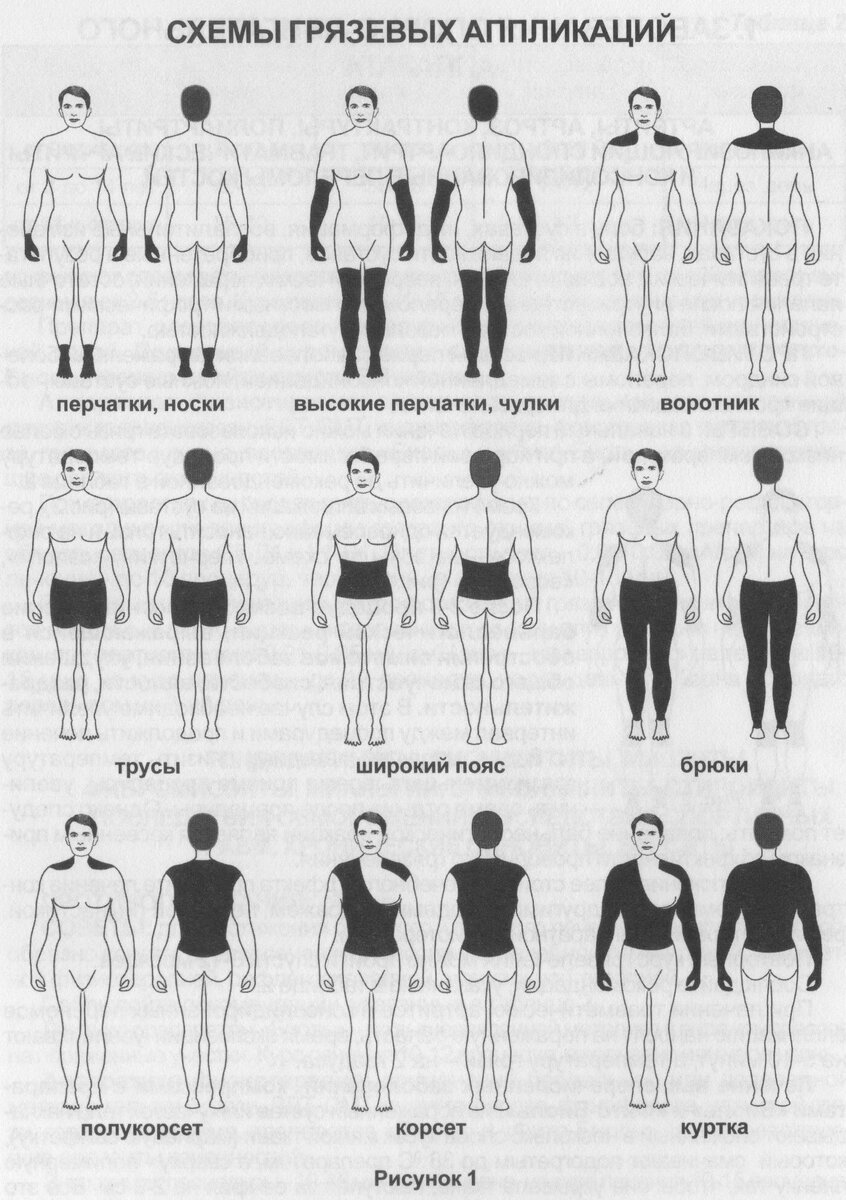 Схема нанесения лечебной грязи