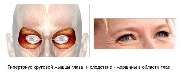 woman secrets Musculos faciales, Músculos de la cara, Anatomía