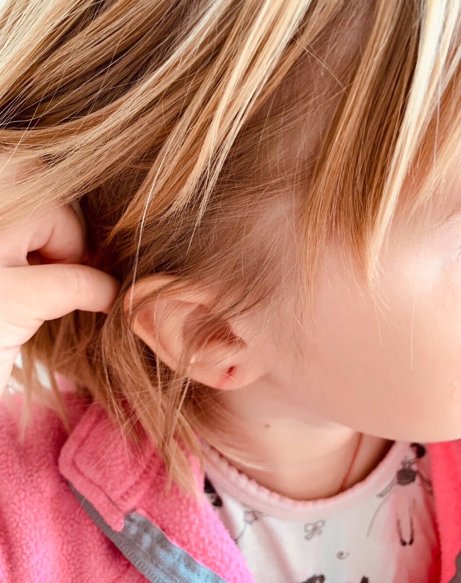 Это первое ушко, из которого клипса выпала сама.