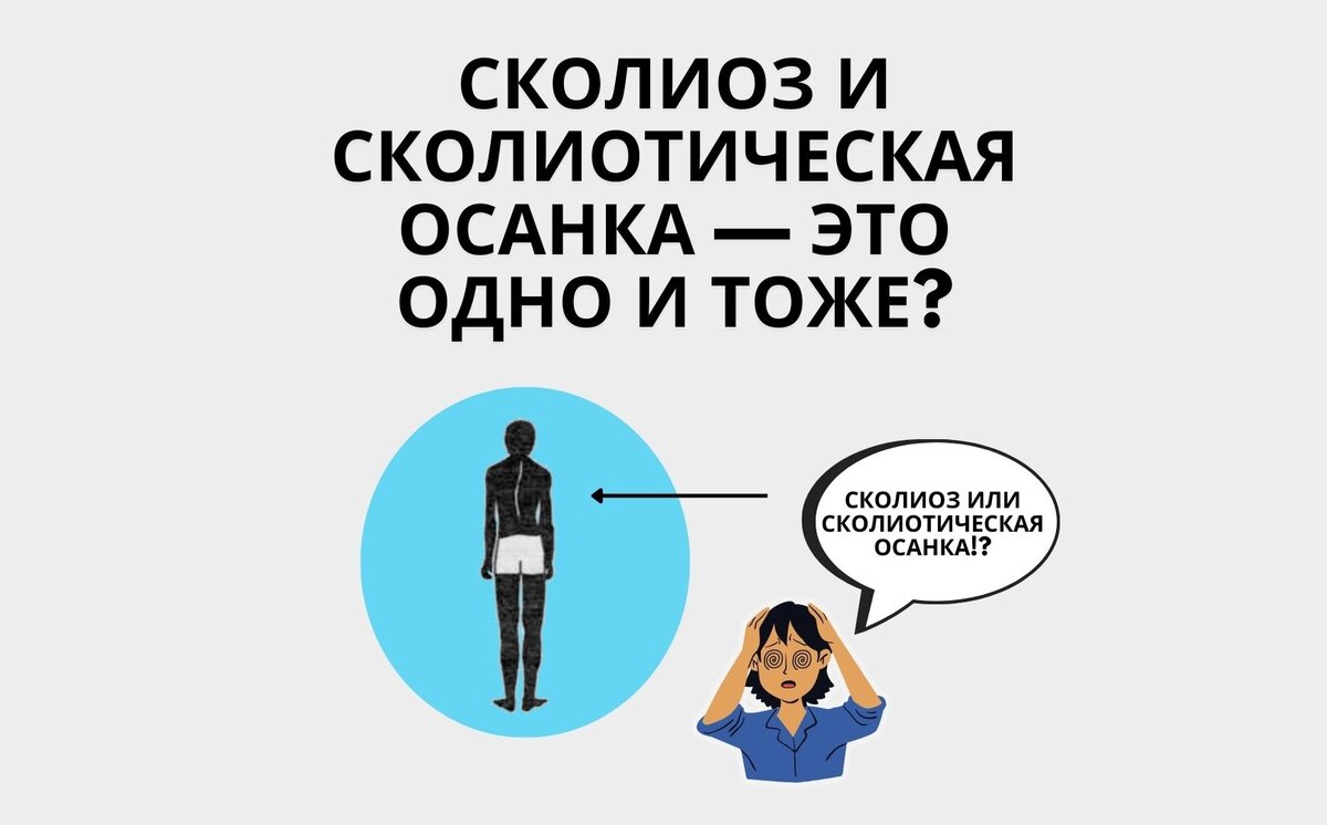 Сколиоз и сколиотическая осанка — это одно и тоже?
