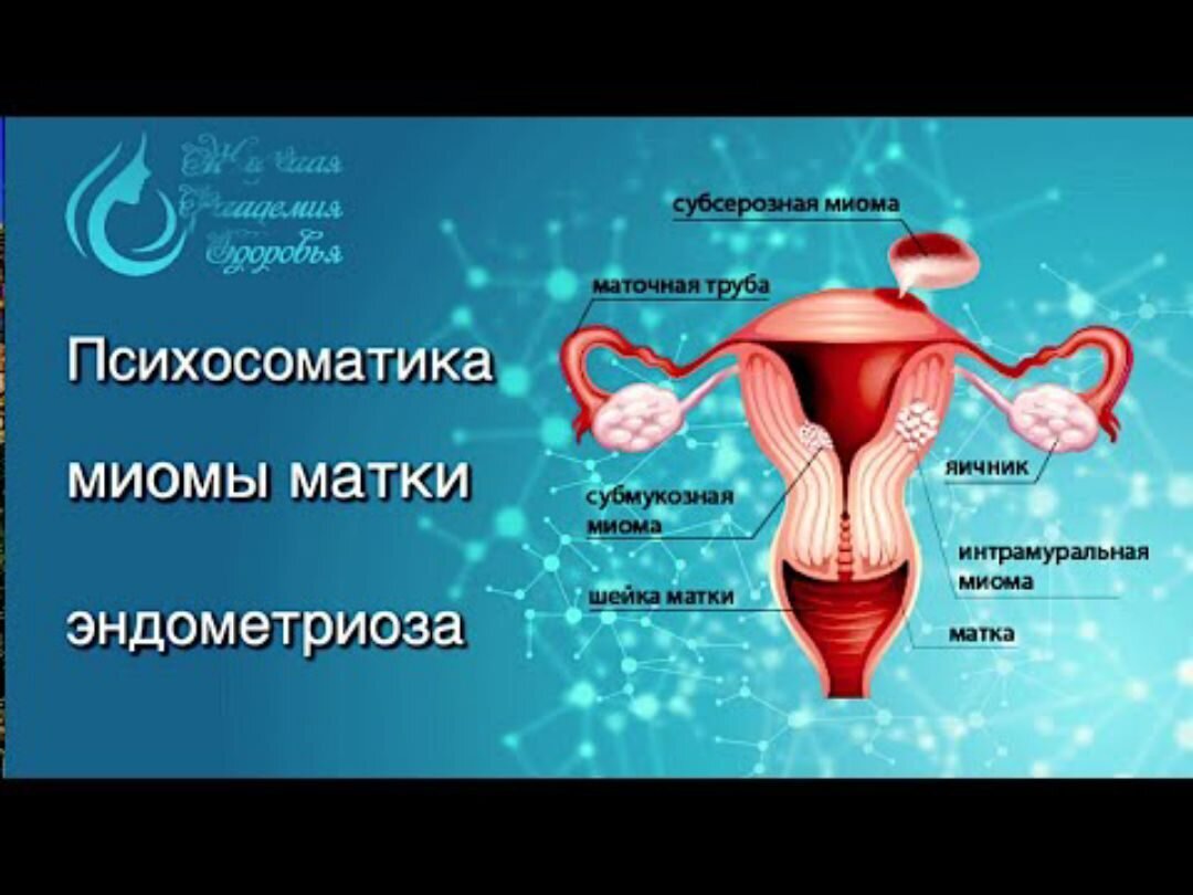 Матка женщины психосоматика. Миома матки психосоматика. Психосоматика заболеваний матки. Эндометриоз матки психосоматика. Психосоматика миома матки и эндометриоз.