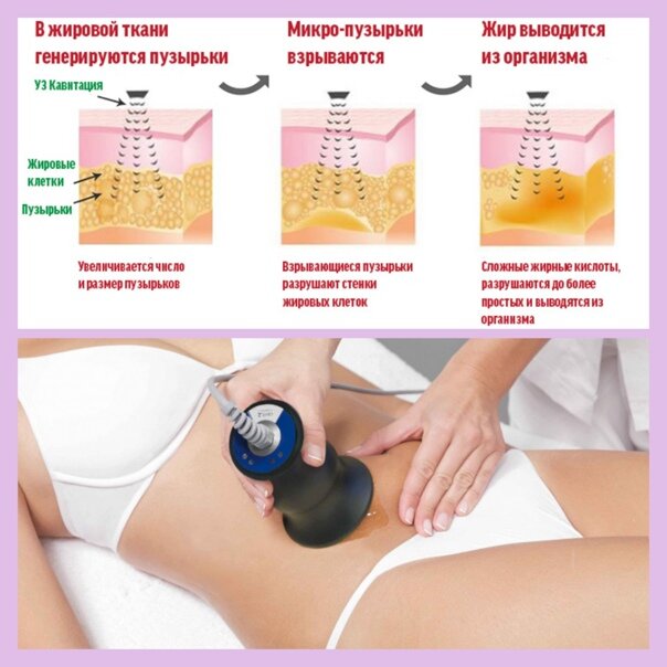 ИМЕЮТСЯ ПРОТИВОПОКАЗАНИЯ. НЕОБХОДИМО ПРОКОНСУЛЬТИРОВАТЬСЯ СО СПЕЦИАЛИСТОМ. 