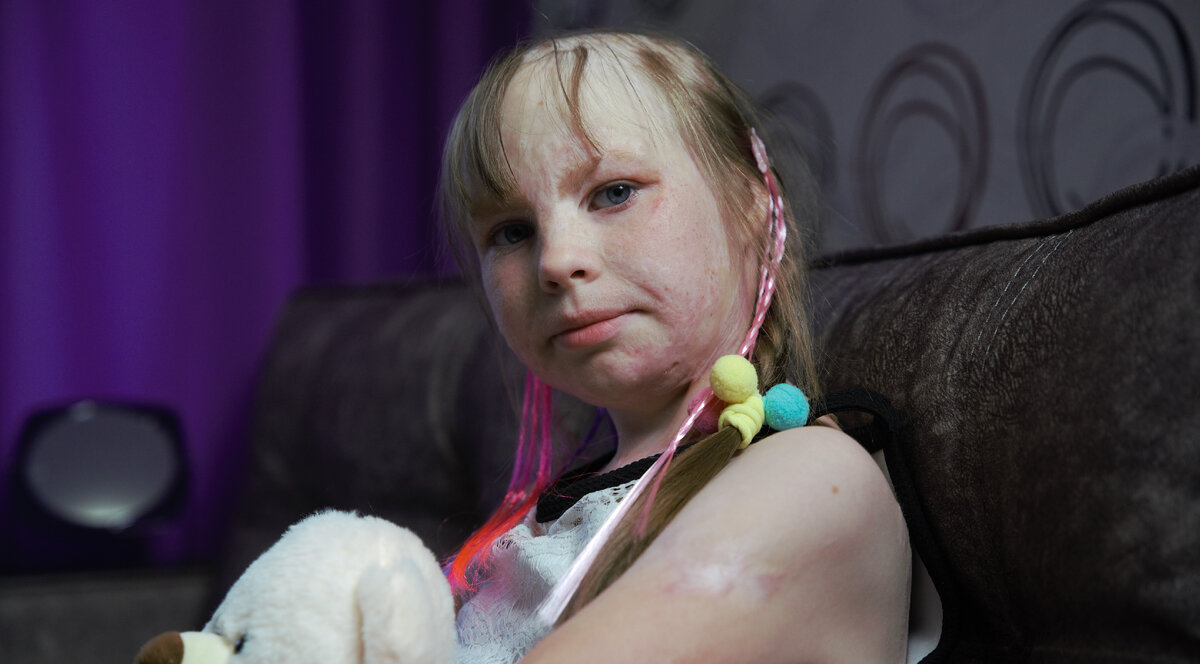 Алеся Петракова, подопечная фонда "Алёша"