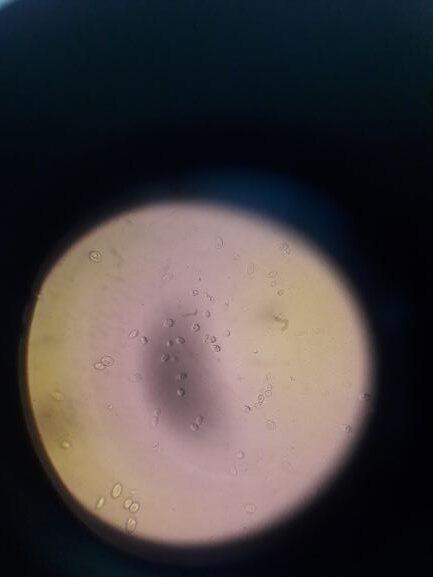 Вот это настоящее живое пиво. Видны живые дрожжевые клетки. Молодые клетки более вытянутые, зрелые более круглые. Есть почкующиеся (делящиеся) клетки.