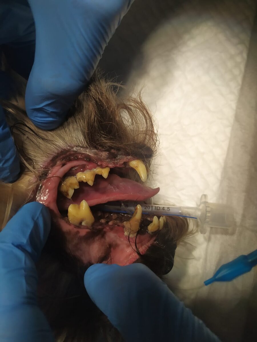 Этому пациенту одним лишь снятием зубных отложений уже не поможешь.