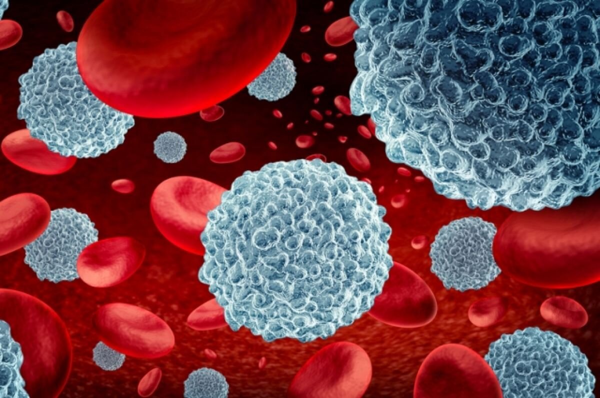    Онколог рассказал, от какого вида рака умирает больше всего людей