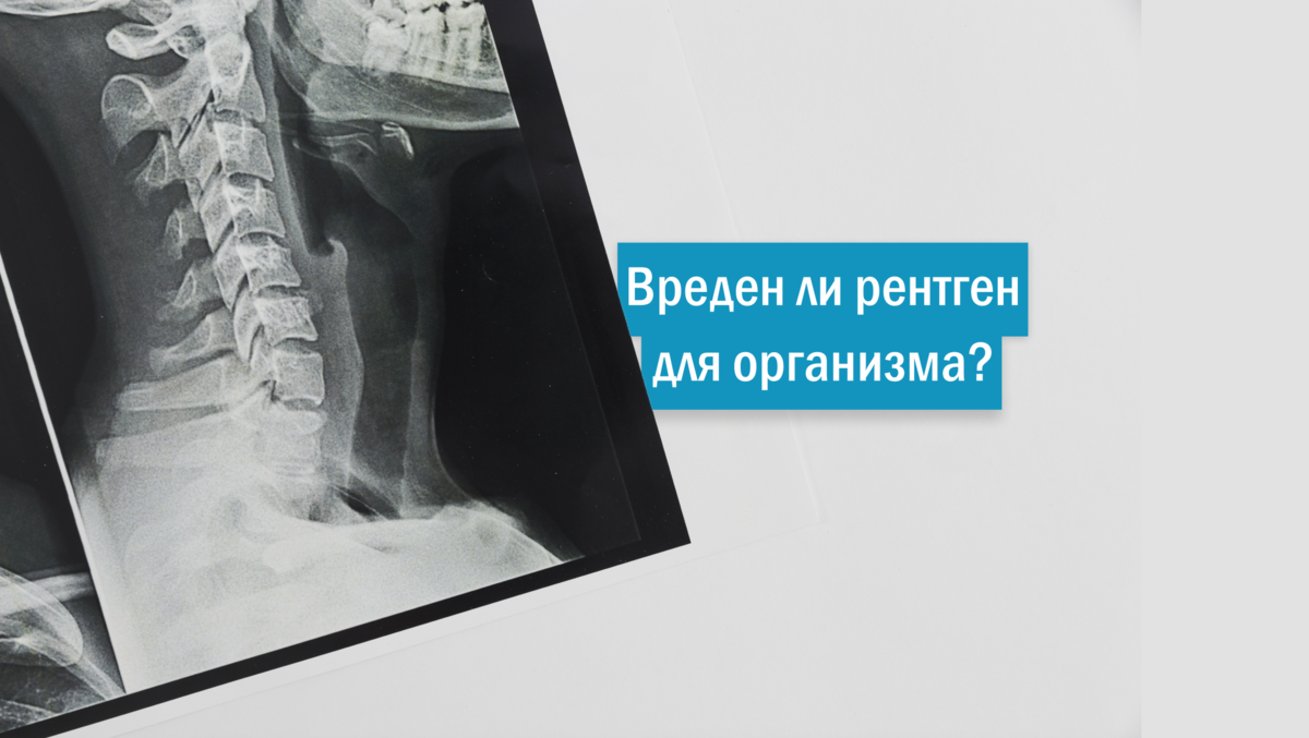 оптг в стоматологии снимок. вреден ли рентген зуба. системы цифровой рентгенографии стоматология. визиография в стоматологии. вреден ли рентген зуба.