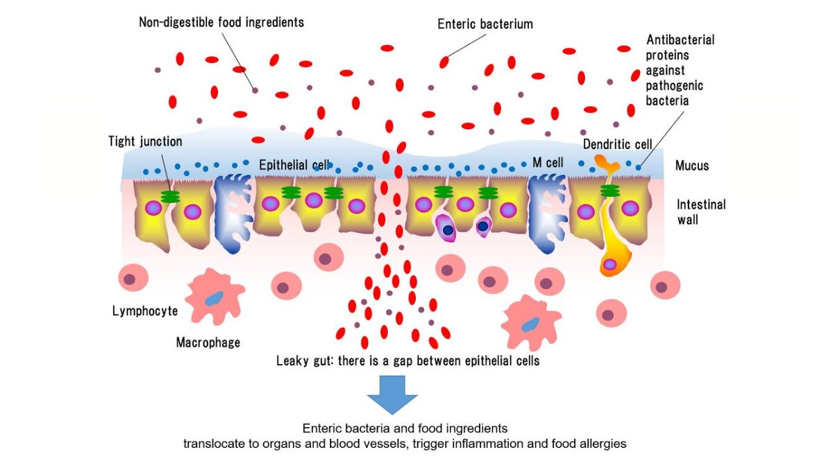 Липополисахарид проникает в кровь через поврежденную НПВП стенку кишки и вызывает аутоиммунное нарушение