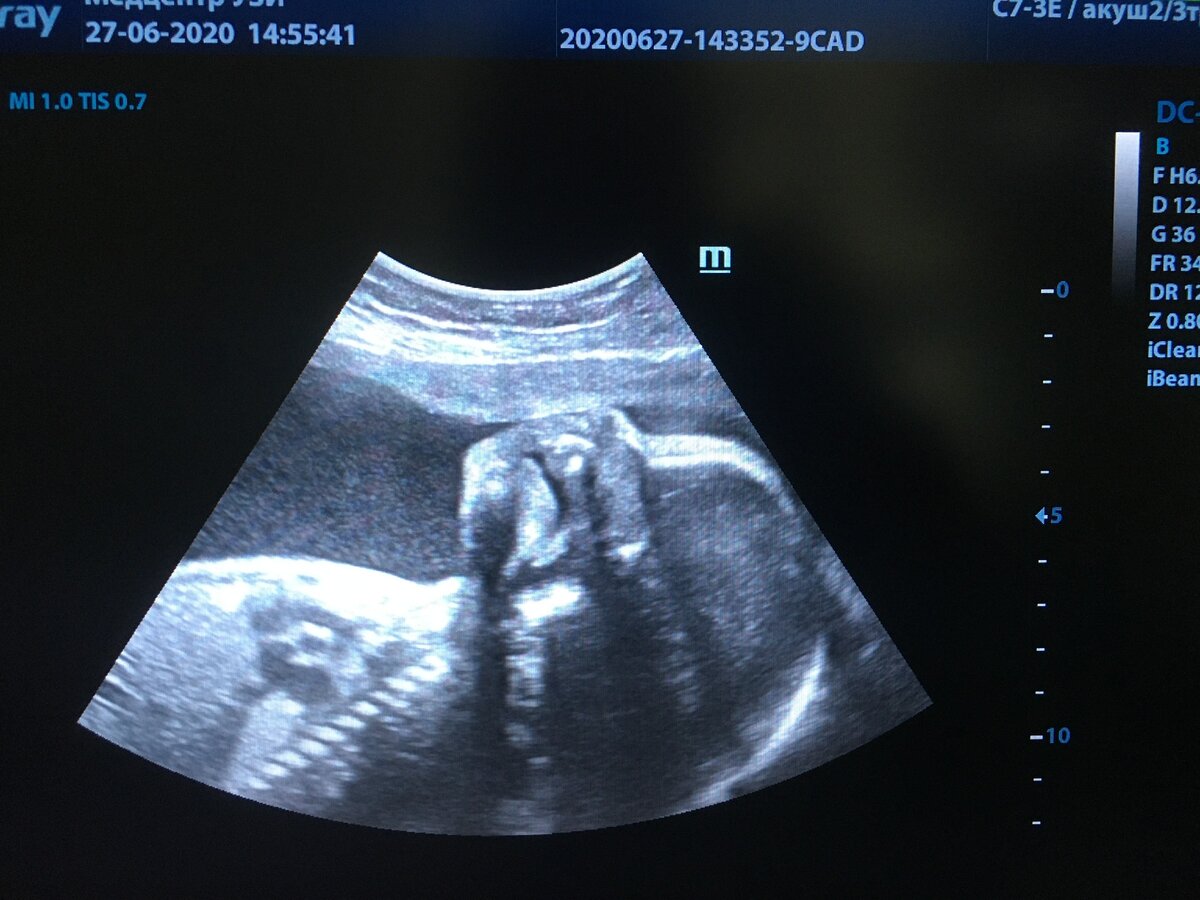 Профиль 3 ребенка. Фото из архива автора.