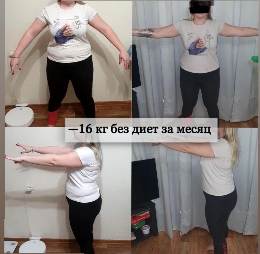 Фото предоставила автор и опубликовано с согласия. Случай из личной практики.