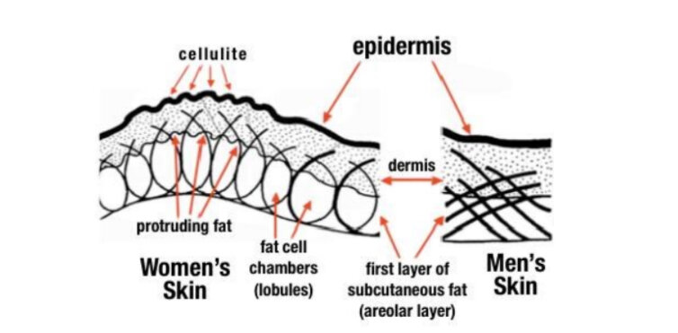 Разница на клеточном уровне в строении подкожно-жировой клетчатки у мужчин и женщин