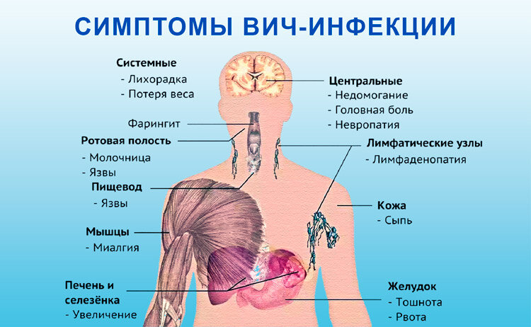 Симптомы вич картинки