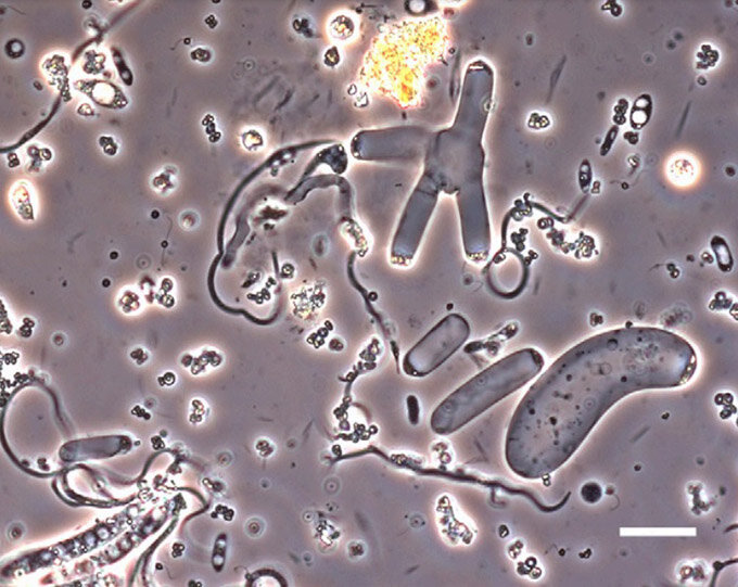 Разноформенные споровики Nephromyces из почечного мешка асцидии Molgula retortiformis. Длина масштабного отрезка – 20 мкм. Фото: PNAS (Saffo et al., 2010).