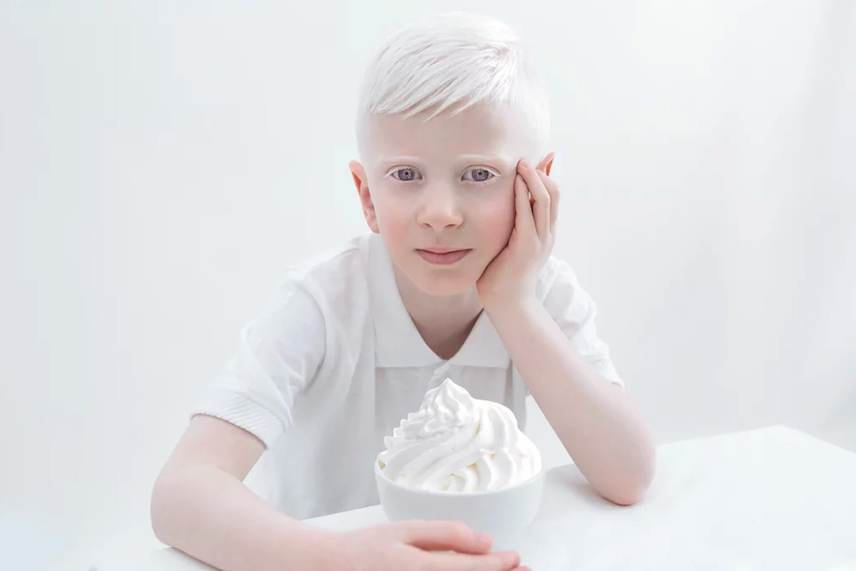 Ребенок родился блондин. Саша Смирнов альбинос. Тося Чайкина альбинос.