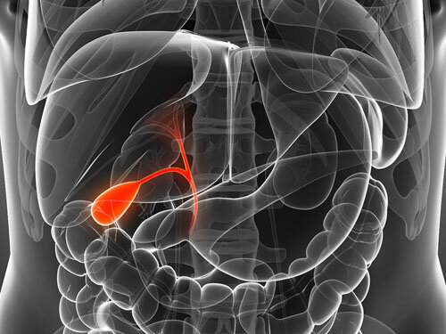 Острый холецистит, что делать?