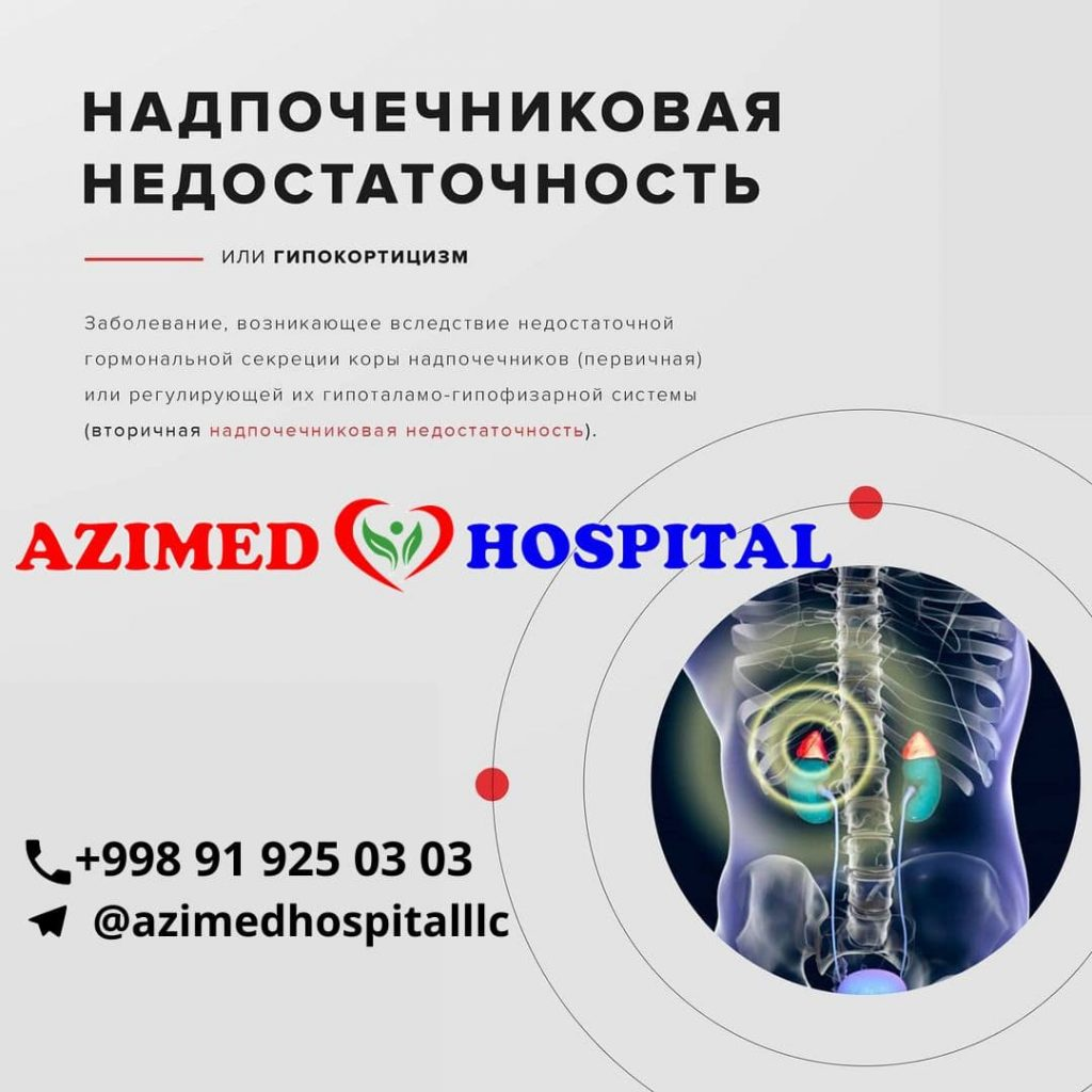 НАДПОЧЕЧНИКОВАЯ НЕДОСТАТОЧНОСТЬ | Клиника Azimed Hospital | Дзен