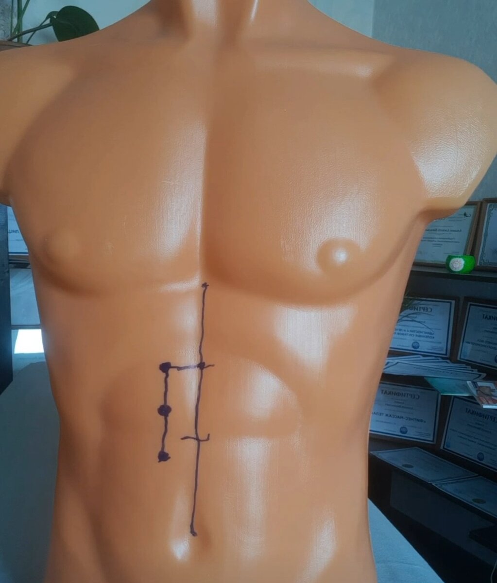 Осноные точки воздействия при вздутии