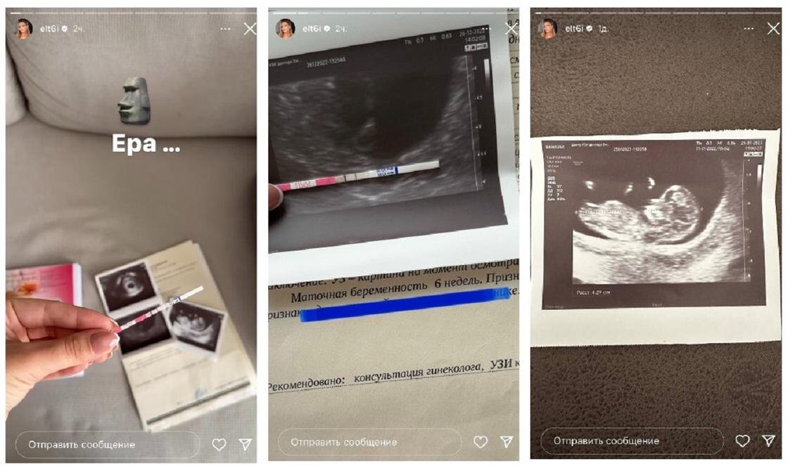    Stories Эльмиры Толегеновой:instagram.com/elt6i