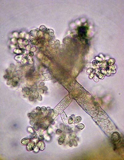 Botrytis Allii под микроскопом