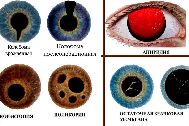 Блог :: ​ЦВЕТ В ИНТЕРЬЕРЕ. ВЛИЯНИЕ ЦВЕТА НА ПСИХИКУ ЧЕЛОВЕКА