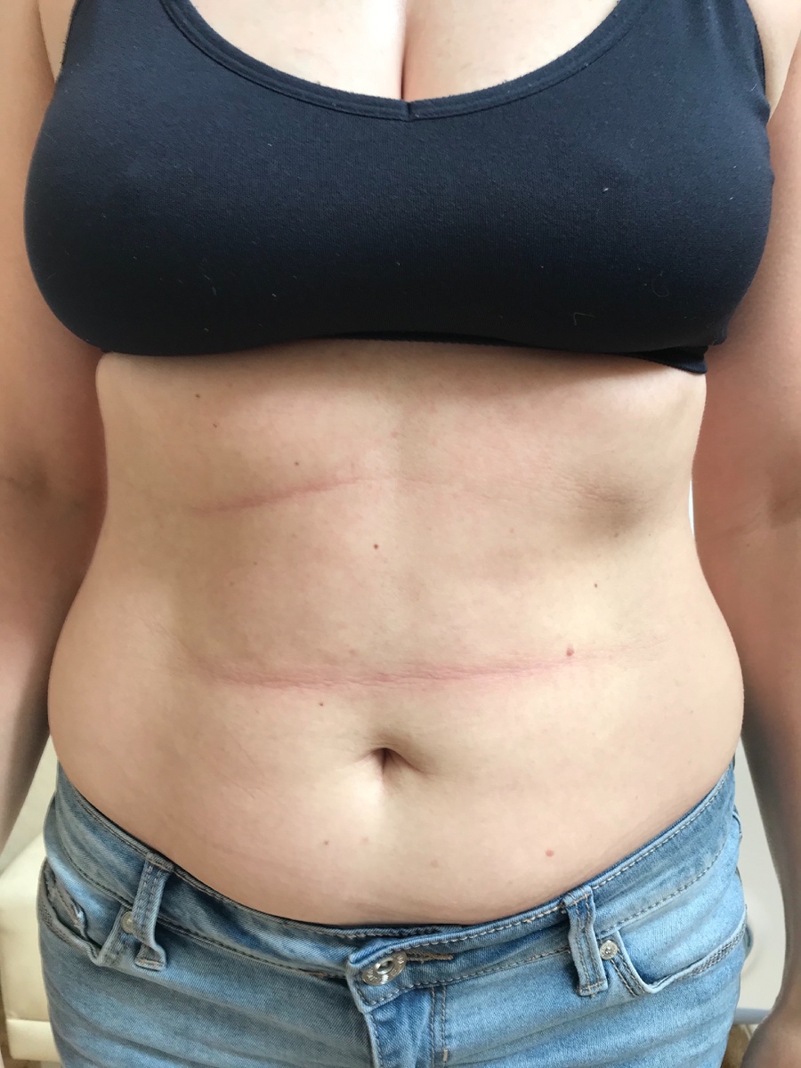 Эмоциональные складки