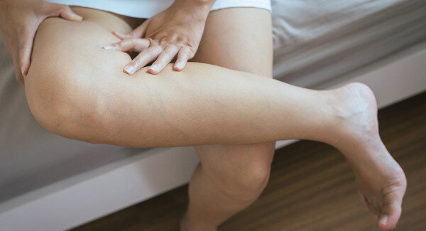 Источник - https://vascul.ru/articles/limfedema-diagnostika-i-lechenie
