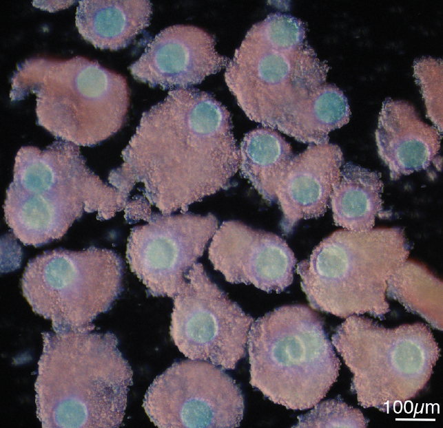 Фолликулы, полученные из стволовых клеток
Takashi Yoshino et al. / Science, 2021
