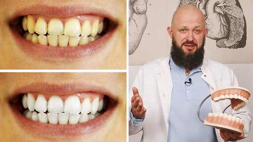 Видео об отбеливании зубов
