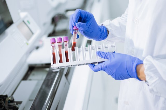    Как расшифровать уровень гемоглобина в анализе крови?