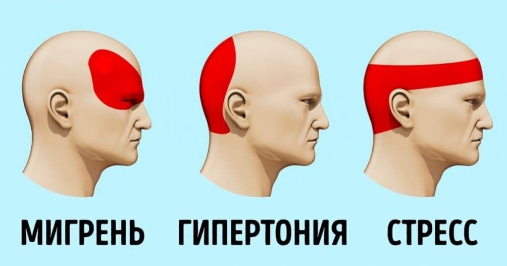 Первая помощь при повышенном артериальном давлении