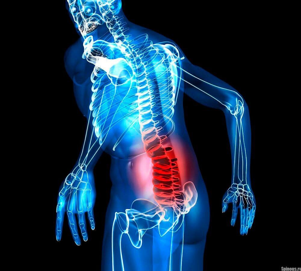 фотография с сайта http://spinous.ru
