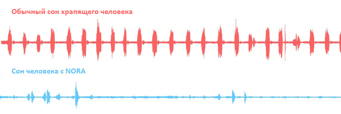 Наглядная статистика сна. Скачки - количество шумов, издаваемых одним и тем же человеком.